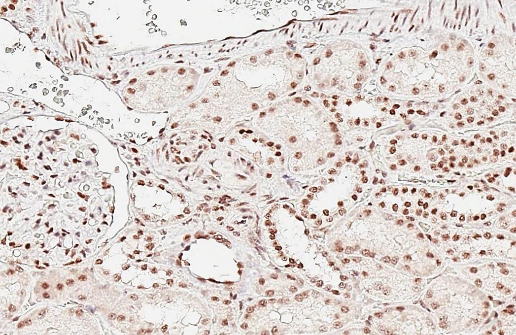 Aly Antibody (HL3813)
