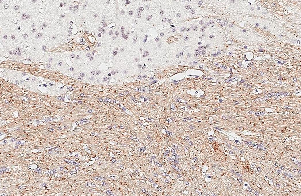 HAPLN2 Antibody (GT107)