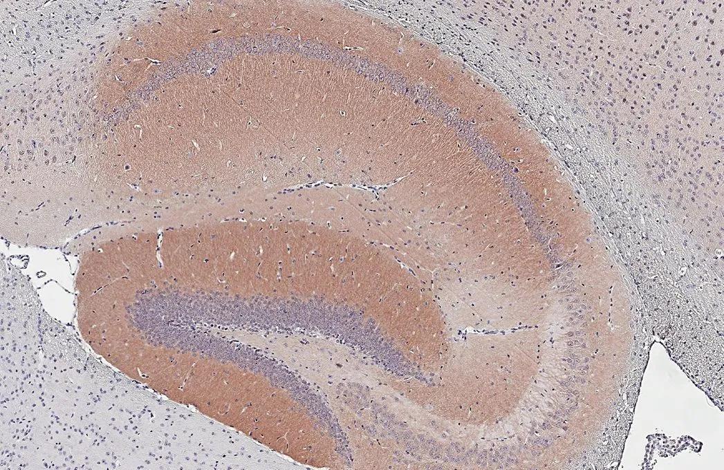 Muscarinic Acetylcholine Receptor M1/CHRM1 Antibody (HL3933)