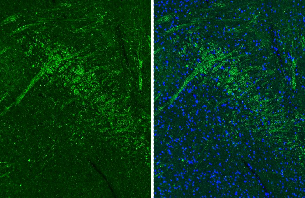Muscarinic Acetylcholine Receptor M1/CHRM1 Antibody (HL3933)