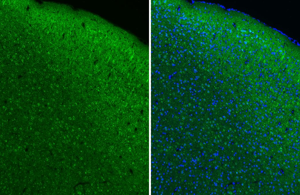 Muscarinic Acetylcholine Receptor M1/CHRM1 Antibody (HL3933)