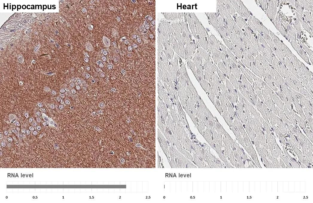 Muscarinic Acetylcholine Receptor M1/CHRM1 Antibody (HL3933)