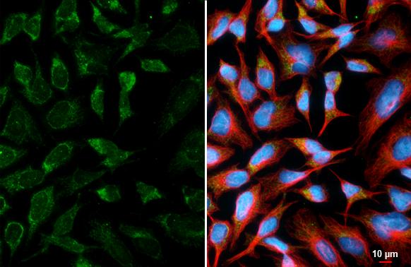 ATPG Antibody (HL3949)