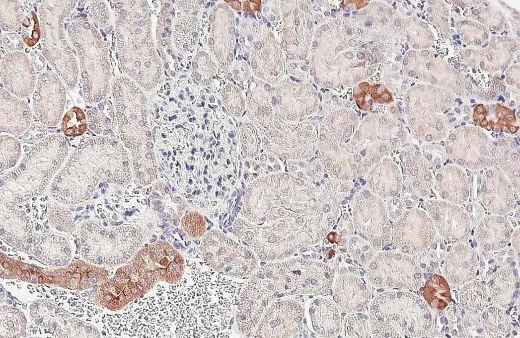 PHACTR1 Antibody (HL3954)