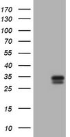 Kallikrein 2 Antibody (OTI5D6) - Azide and BSA Free