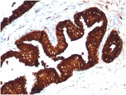 Kallikrein 3/PSA Antibody (KLK3/4602R)