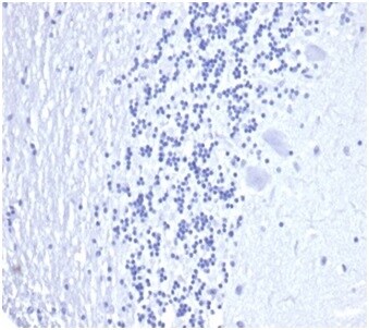 Kallikrein 3/PSA Antibody (KLK3/4602R)