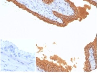 Kallikrein 3/PSA Antibody (KLK3/7128R)