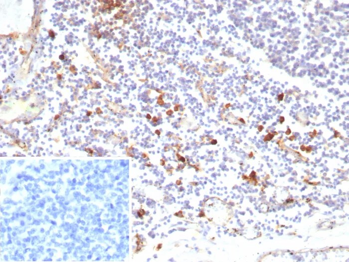 IL-3R alpha/CD123 Antibody (rIL3RA/9212)