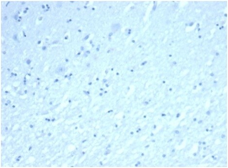 Inhibin alpha Antibody (rINHA/6919)