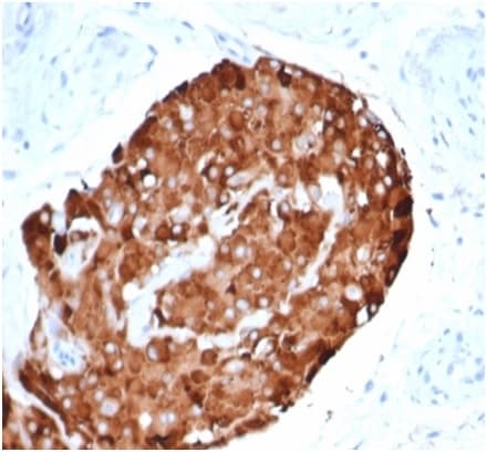 Inhibin alpha Antibody (rINHA/6919)
