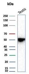 Inhibin alpha Antibody (rINHA/6919)