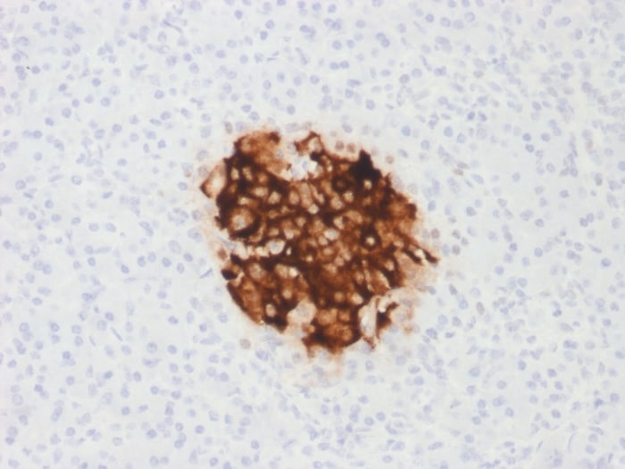 Insulin Antibody (rIRDN/805)