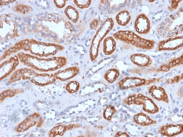 Integrin beta 3/CD61 Antibody (rITGB3/1713)