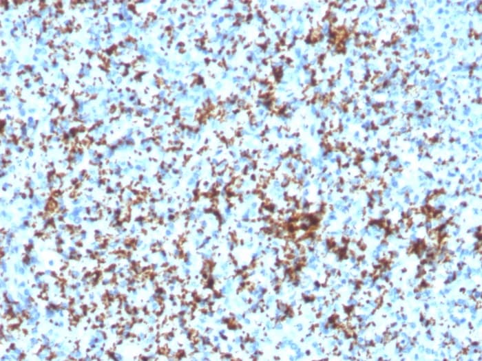 Integrin beta 3/CD61 Antibody (ITGB3/3126R)