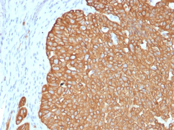 Cytokeratin 5 Antibody (KRT5/4245R)