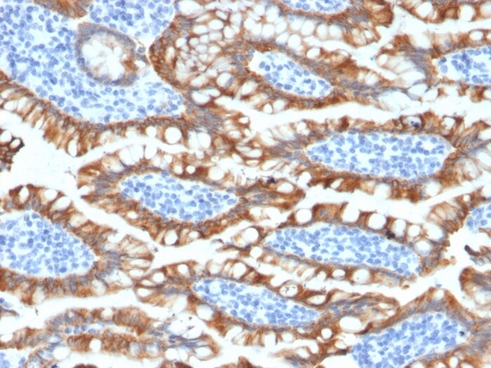 Cytokeratin 8 Antibody (KRT8/2174R)