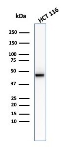 Cytokeratin 8 Antibody (KRT8/2174R)