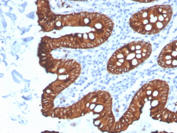 Cytokeratin 8 Antibody (KRT8/4067R)