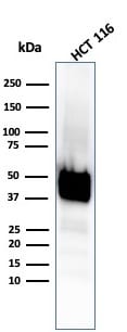Cytokeratin 8 Antibody (KRT8/4067R)