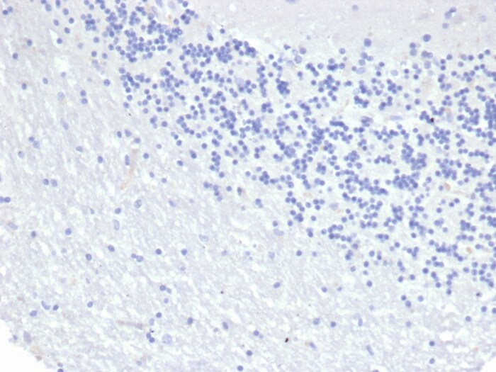 Cytokeratin 8 Antibody (KRT8/6472R)