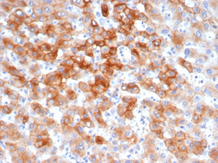 Cytokeratin 8 Antibody (KRT8/6472R)