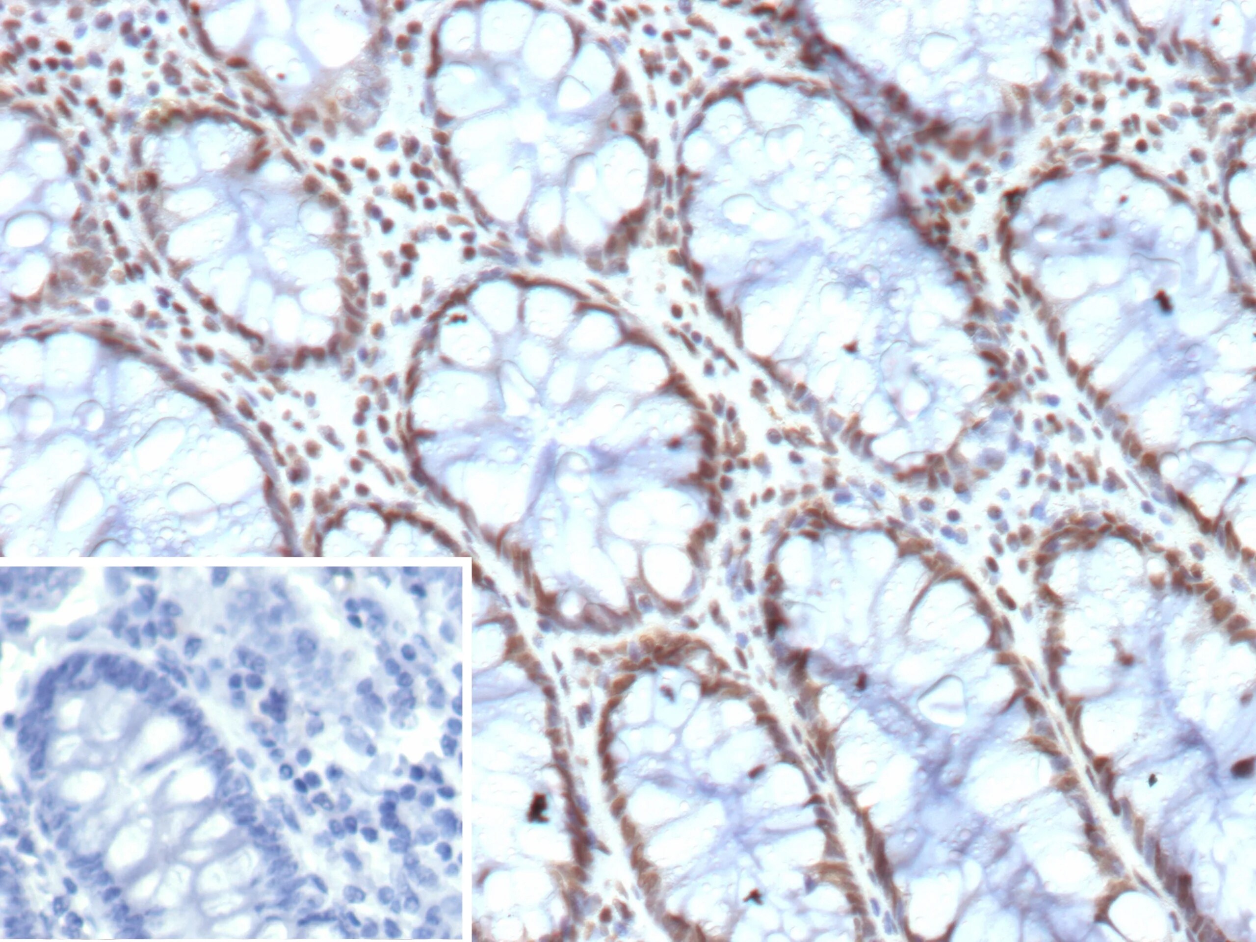 HES5 Antibody (HES5/8035)