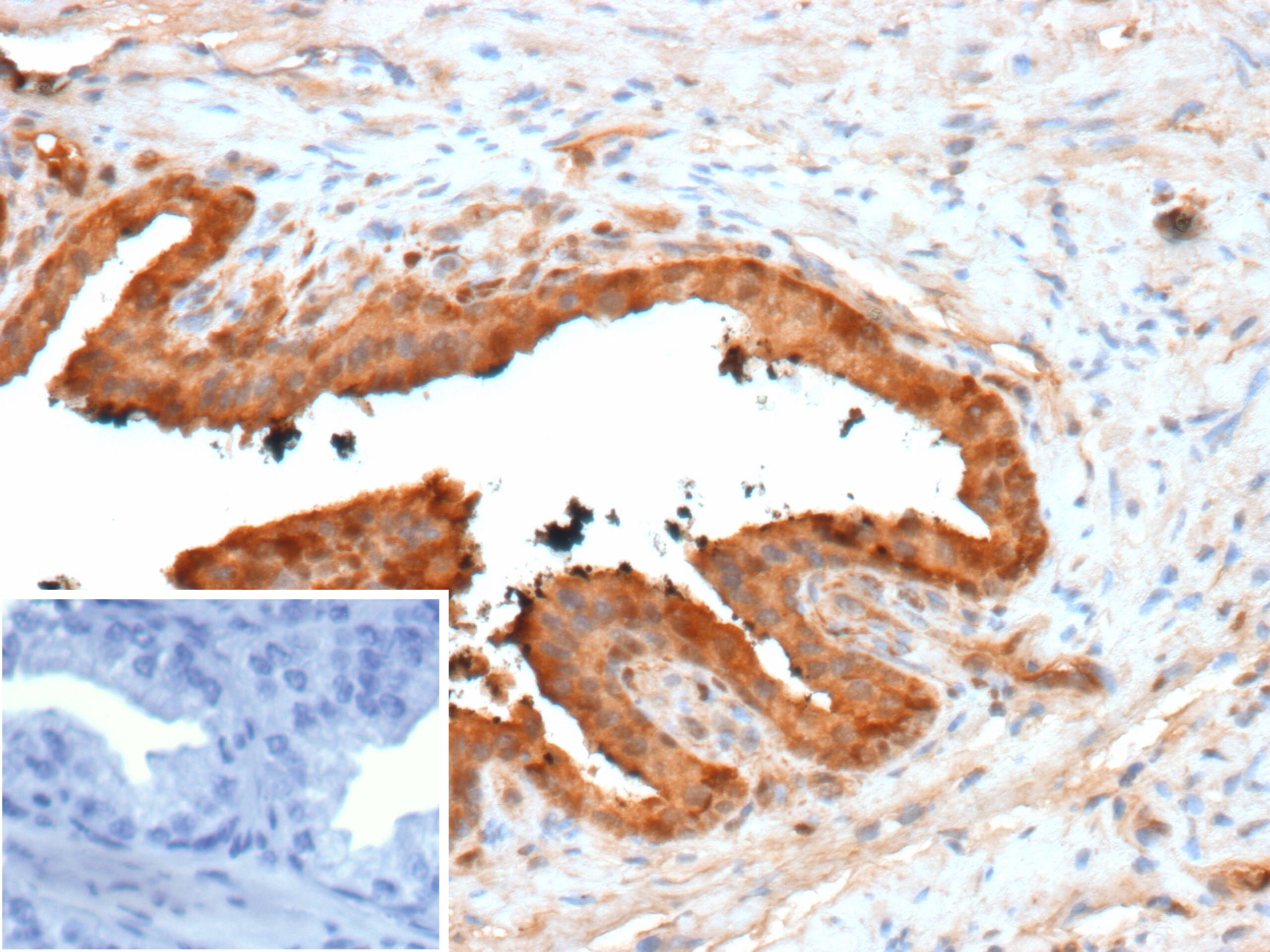 Galectin-3 Antibody (LGALS3/13233R)