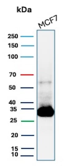 Galectin-3 Antibody (LGALS3/13233R)