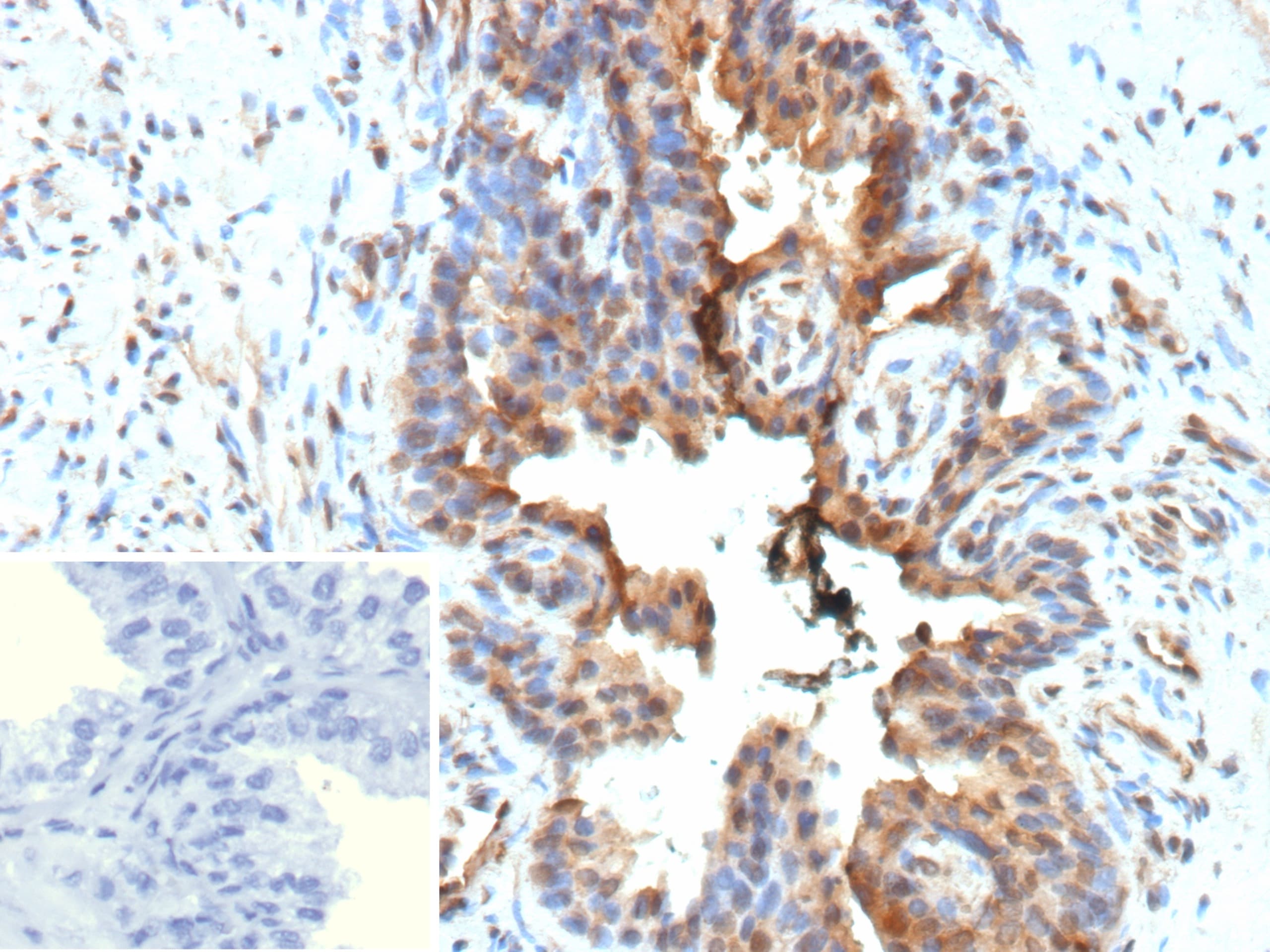 Galectin-3 Antibody (LGALS3/13208R)