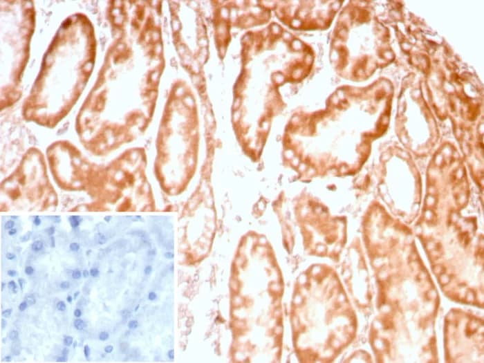 LRP-1 Antibody (LRP1/8947R)