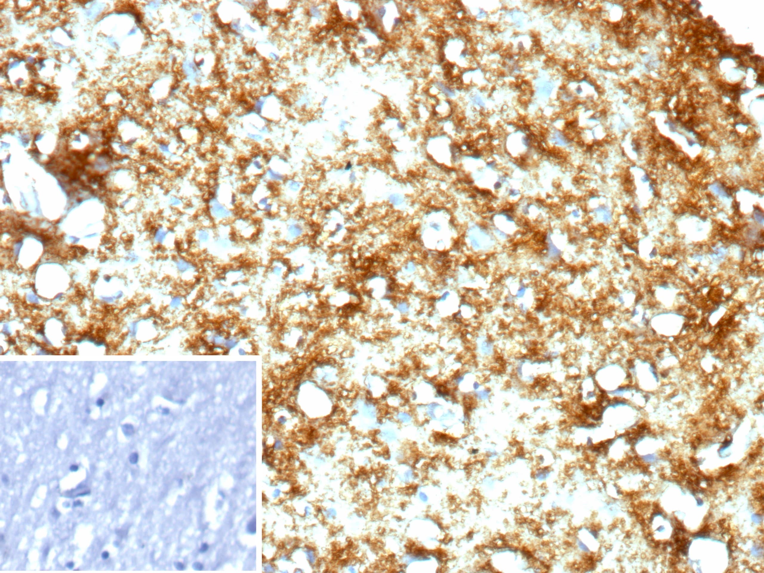 MBP Antibody (rMBP/9431)