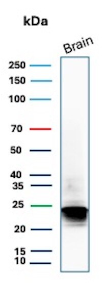 MBP Antibody (rMBP/9431)
