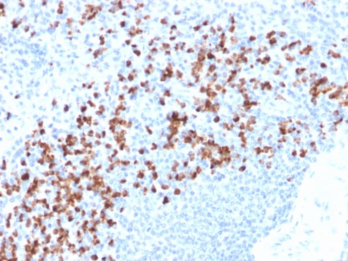 MMP-9 Antibody (rMMP9/1769)