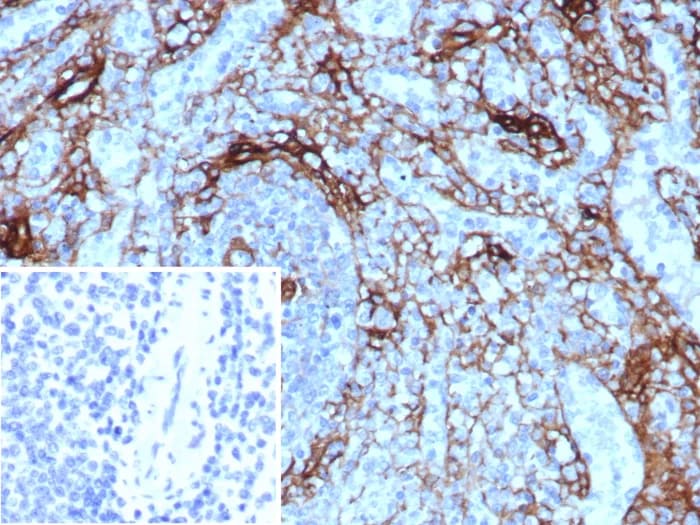 NGFR/TNFRSF16/p75NTR Antibody (NGFR/8590R)