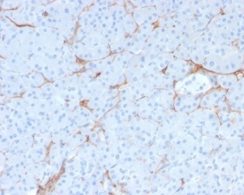 NGFR/TNFRSF16/p75NTR Antibody (NGFR/1997R)