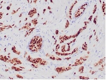 Progesterone R/NR3C3 Antibody (PGR/6854R)