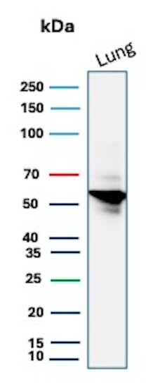 Serpin A1/alpha 1-Antitrypsin Antibody (AAT/3167R)