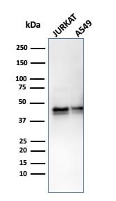 Serpin A1/alpha 1-Antitrypsin Antibody (AAT/3167R)