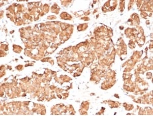 ACTH Antibody (rCLIP/3814)