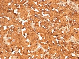 ACTH Antibody (rCLIP4278)