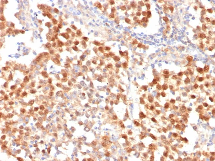 OCT4 Antibody (OCT4/7347R)