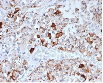 Prolactin Antibody (rPRL/4907)