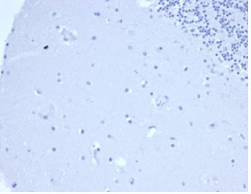 Prolactin Antibody (rPRL/4907)