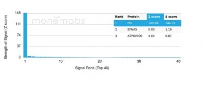 Prolactin Antibody (rPRL/4907)