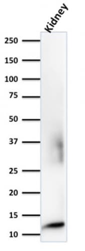 beta 2-Microglobulin Antibody (rB2M/961)