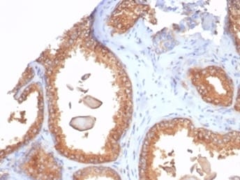 beta 2-Microglobulin Antibody (rB2M/7279)