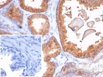 beta 2-Microglobulin Antibody (rB2M/7279)