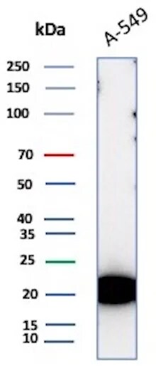 Bax Antibody (BAX/9925R)