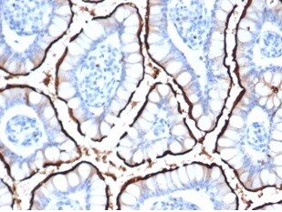 ACE-2 Antibody (ACE2/6788R)
